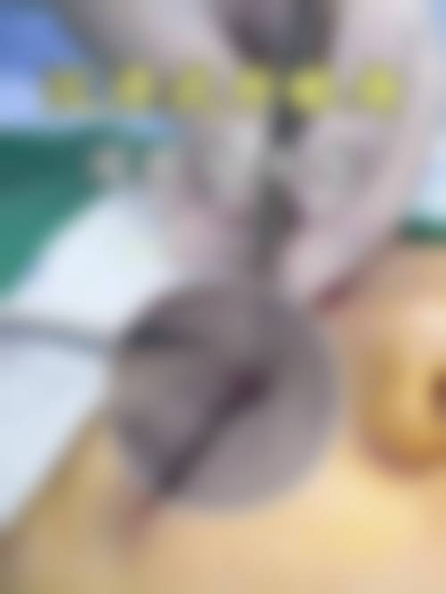 西安西 京医院整形科鼻部整形价格