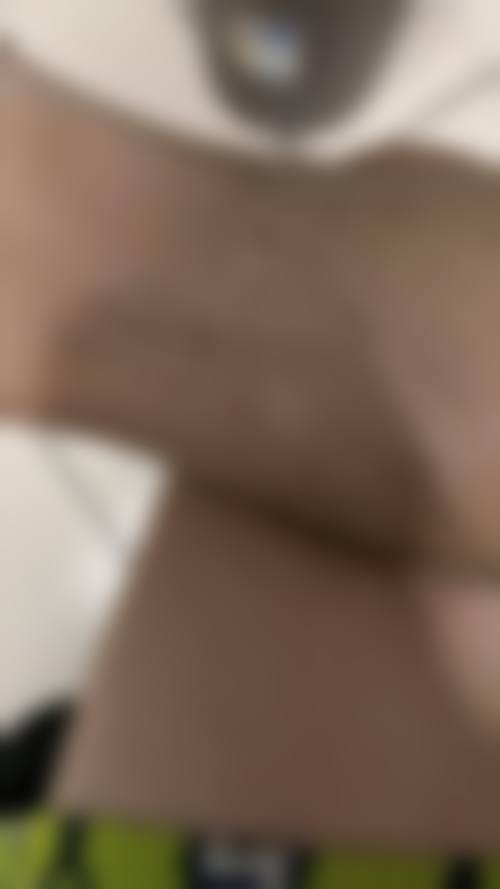 武汉臻颜名美（原迪美）医疗美容门诊部收费价格表（2026 年）