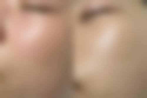 北京瑞丽舍医学美容机构价目表