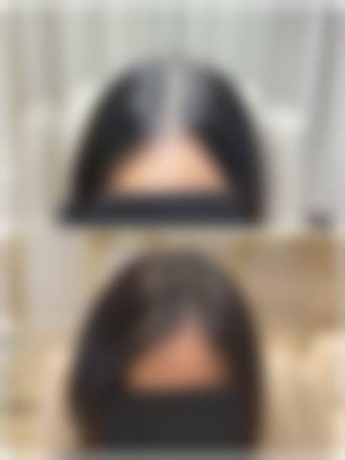 重庆大麦微针植发医院简介