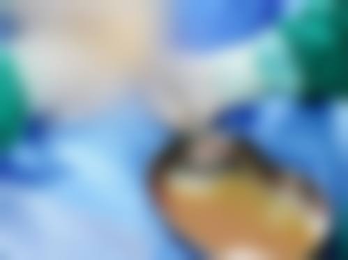 三、医生团队在注射隆胸取出中的重要性