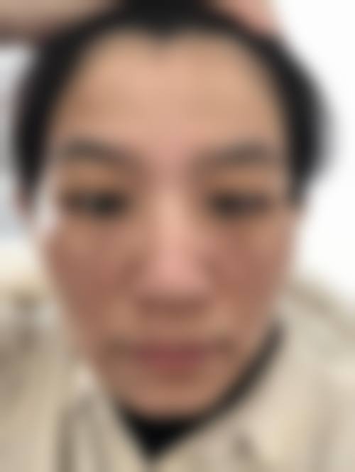 汕头附二医院美白嫩肤多少钱