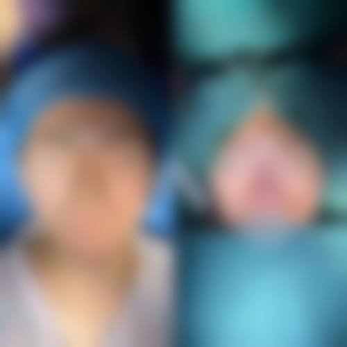 黄良飞医生眼鼻整形技术亮点