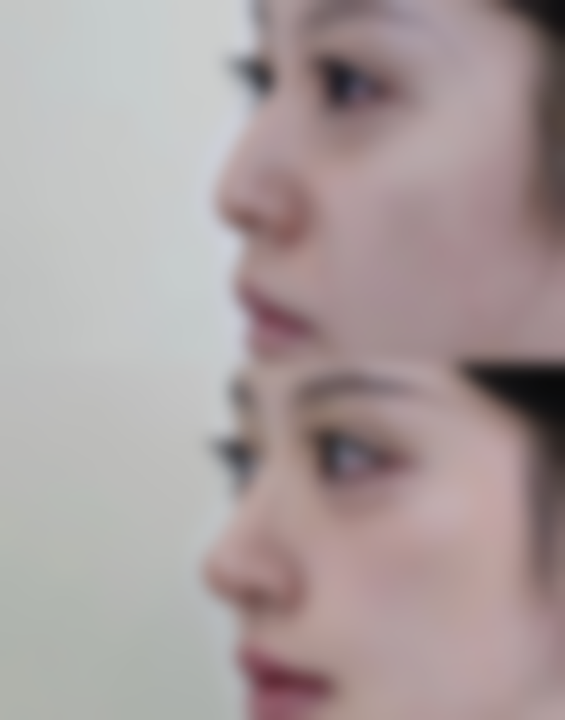 六、如何判断自己是否适合上海虹桥医院的手术