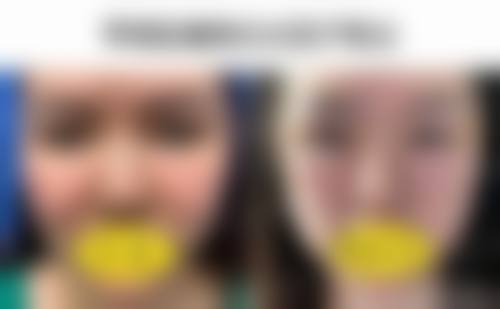 齐云香医生患者好评与真实实例