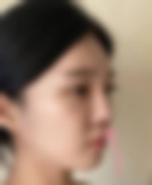 深圳美一度医疗美容门诊部价格表