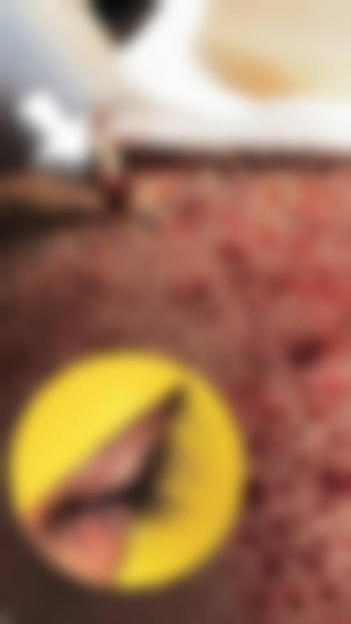 二、天津连锁品牌纹眉医院推荐