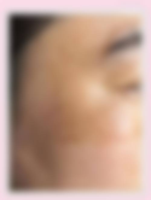 三、北京301医院激光美容中 心的医生团队