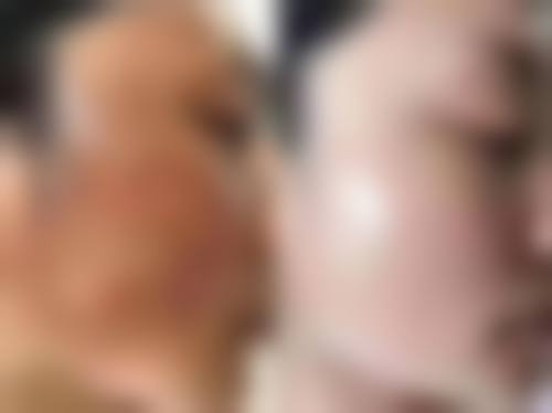 六、北京301医院激光美容中 心的预约与价格