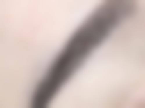 杨凡医生口碑评价及真人实例