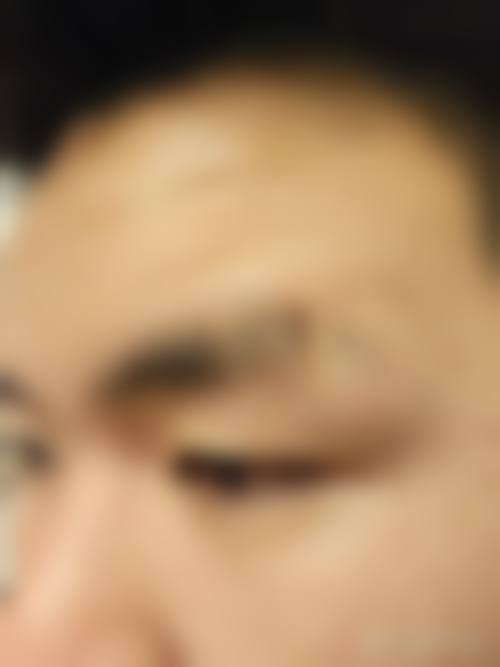 杨凡医生擅长项目