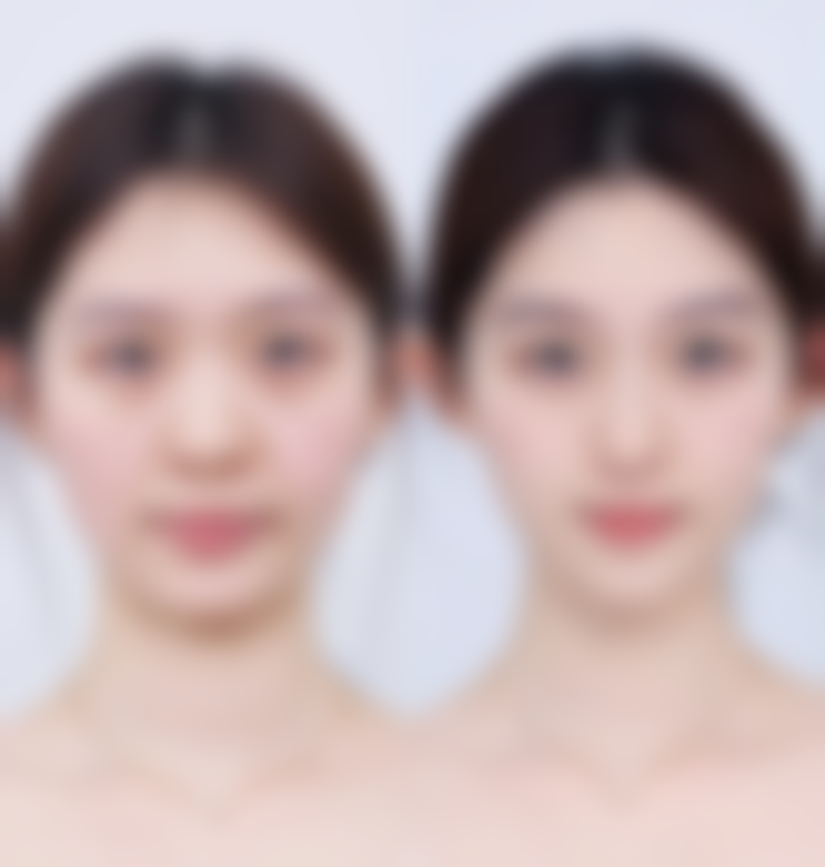 六、韩国诺宝丝整形医院价格区间及收费说明