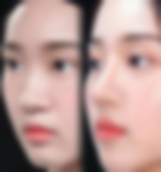 四、复杂项目及有基础病选三等甲