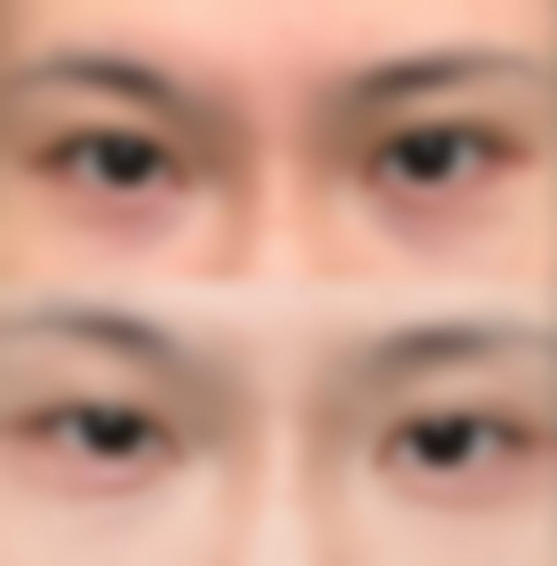 冯啸医生口碑评价及真人实例