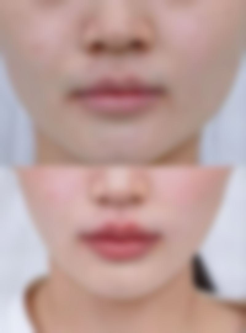 孙祖斌医生擅长项目