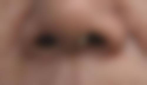 惠州韩妃美容医院(原瑞芙臣)值得选吗？｜刘丹虹主刀，鼻眼整形口碑超赞