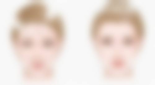 杨 凡医生口碑评价及真人实例