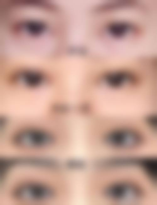 冯啸医生技术优势