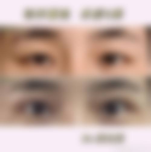 胡寅医生口碑评价及真人实例