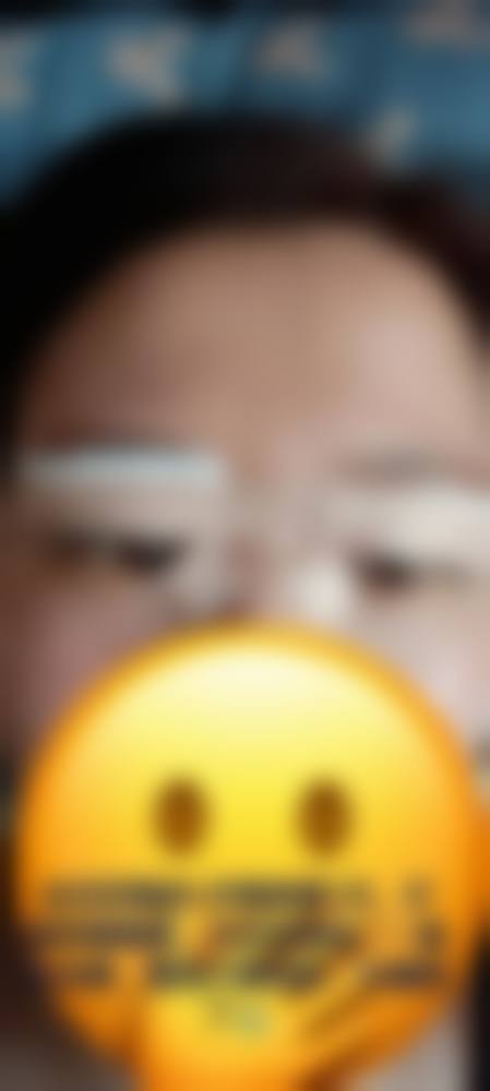 深圳米兰柏羽整形医院：独特优势塑造美丽双眼