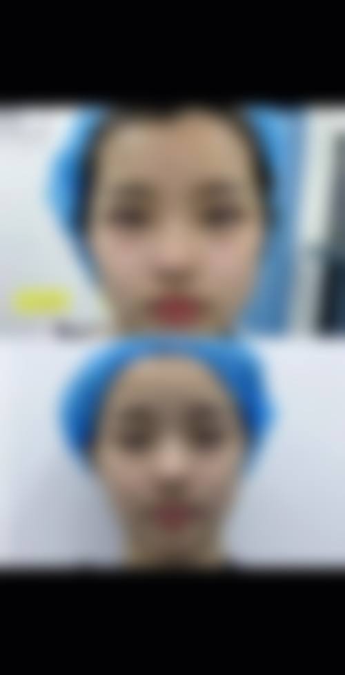 深圳鹏爱医疗美容医院：微创技术助力快速修复