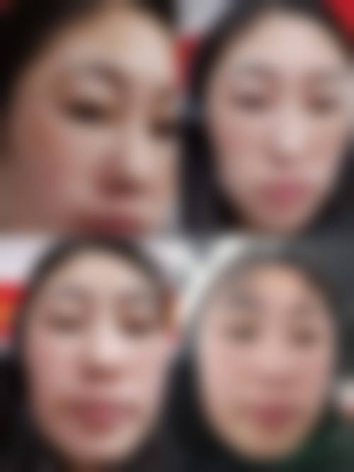 深圳汇俪整形医院收费价格表/收费标准