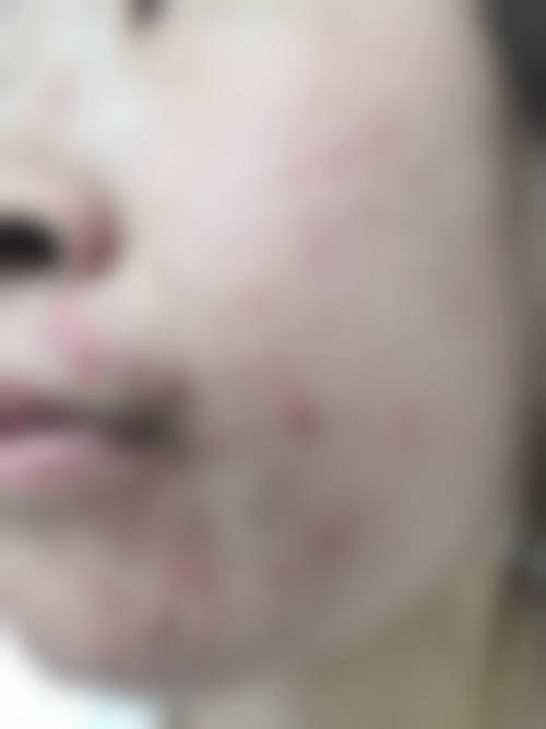 二、上海曼领医疗美容医院的医生团队如何