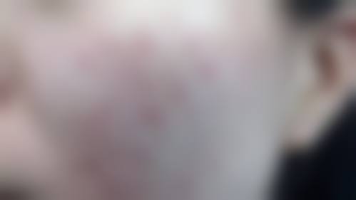 四、上海曼领医疗美容医院的服务模式好吗