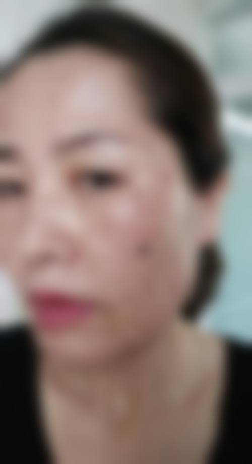 平顶山汝州臻美医疗美容门诊部真实实例