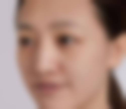 深圳汇俪整形医院真人口碑评价怎么样？