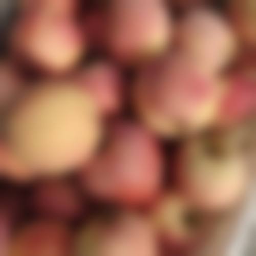 2026武汉协和医院毛发移植价格更新