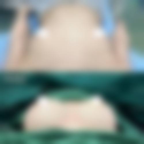 四川宜宾华仁整形正规可靠吗?