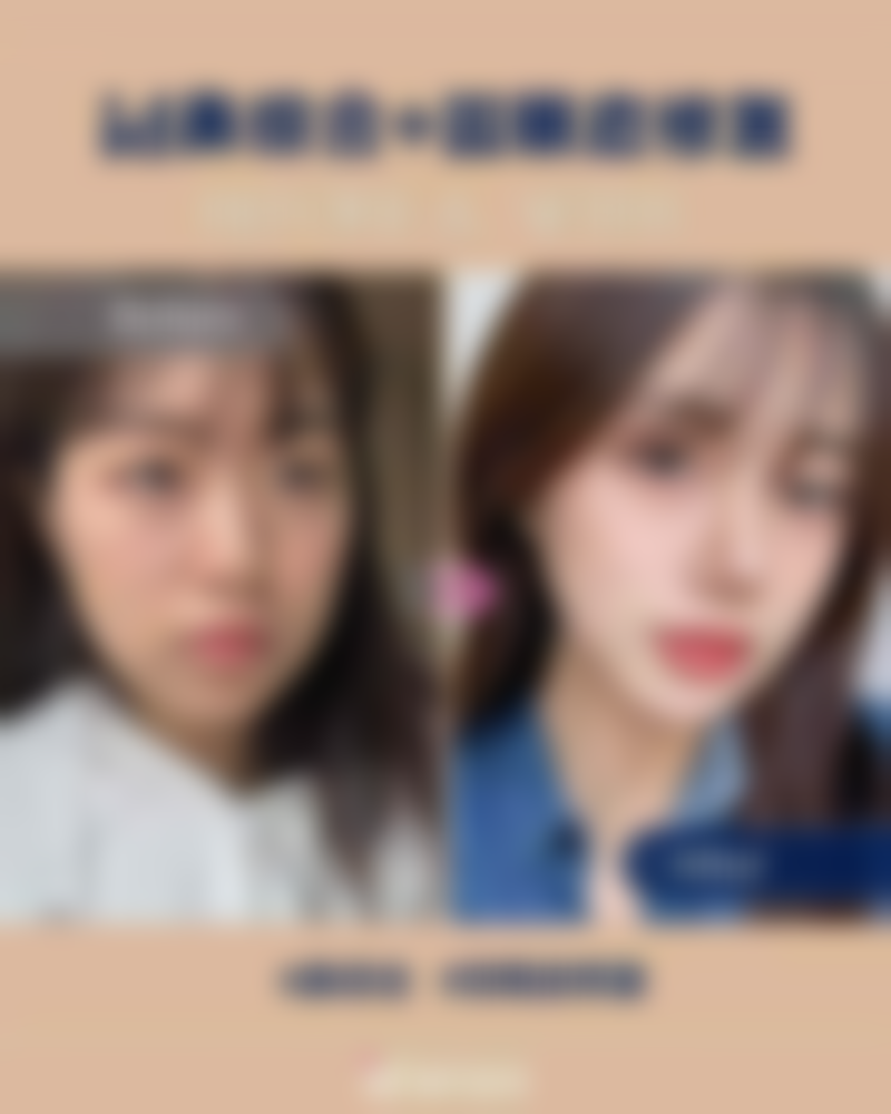 三、沈阳元辰医疗美容门诊部热门项目