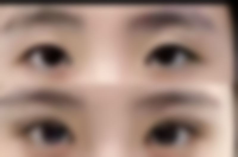 胡寅医生技术优势