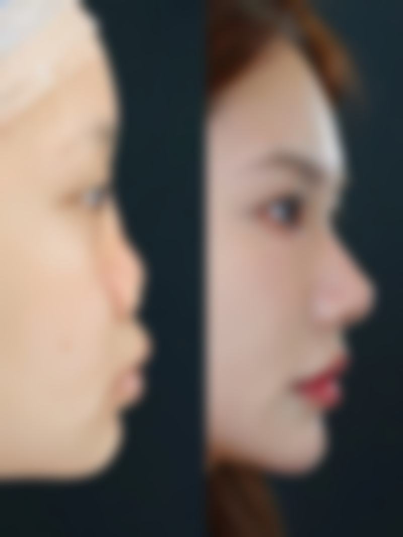 韩国ITEM整形外科医院价格表