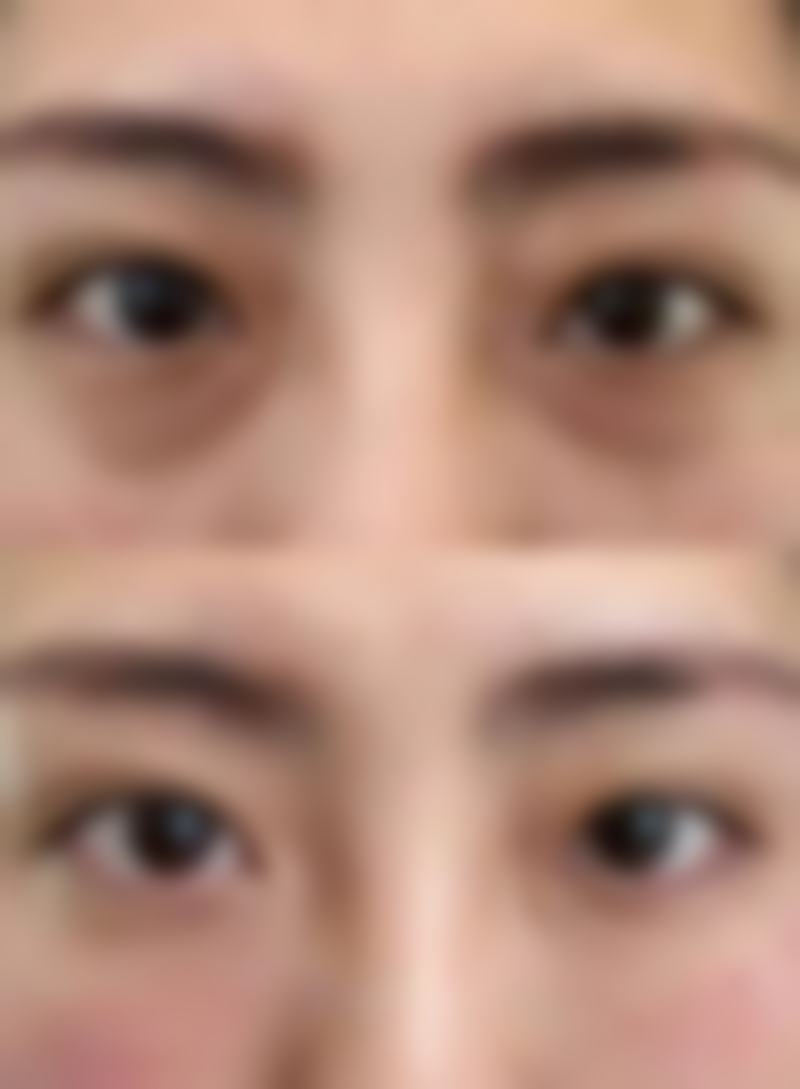 杨 凡医生口碑评价及真人实例