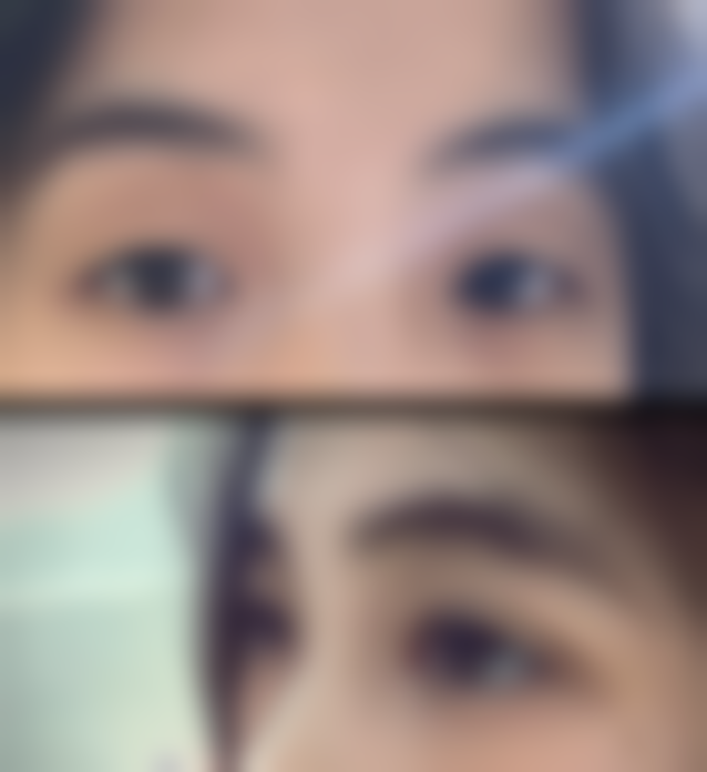 八、重庆市华美紫馨整形美容医院真人口碑评价怎么样?