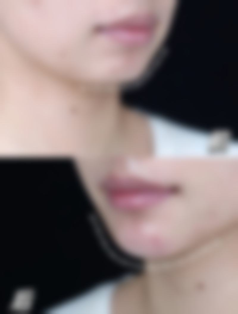 邯郸金皇后医疗美容诊所真实实例