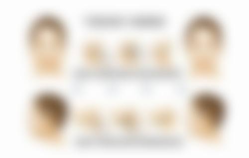 杨凡医生擅长项目