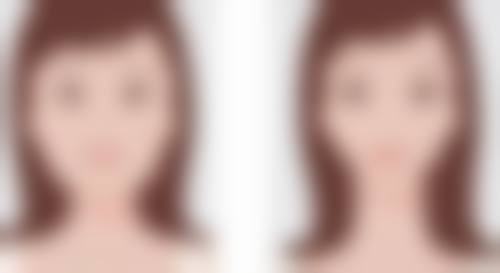 杨凡医生技术优势