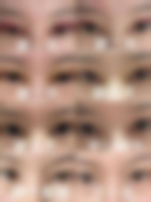 性价比高口碑佳的史迎军眼修复