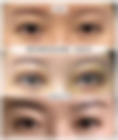 张沙沙医生鼻部整形亮点