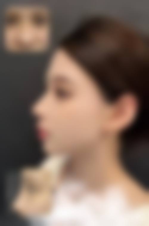 南昌韩美整形美容医院真人口碑评价怎么样？