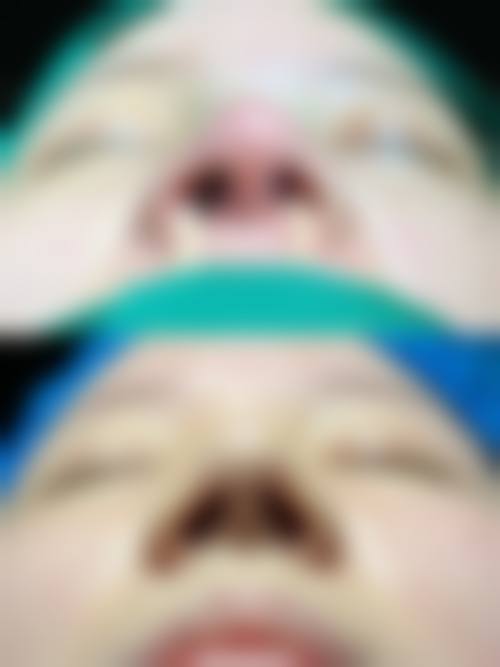 画美张沙沙手术预约：电话/在线/现场3种通道，眼鼻整形实力派安心约