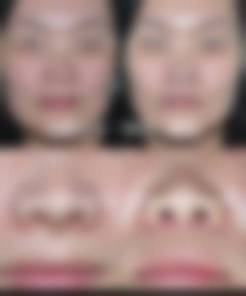 广州王芳娇医生:温柔细腻,全流程关怀