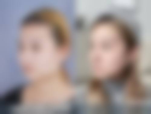 苏曼医生擅长项目