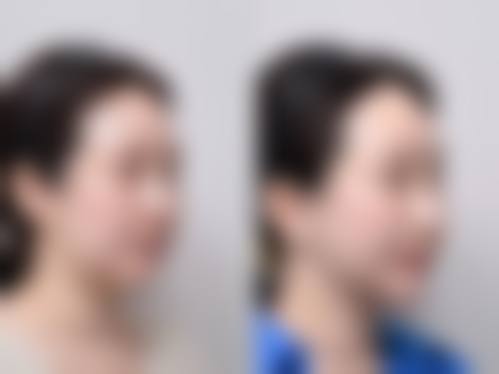 曹晗医生坐诊医院