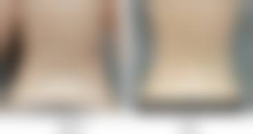 苏曼医生口碑评价及真人实例