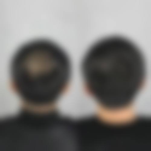 六、西安大麦微针植发的环境和位置如何？