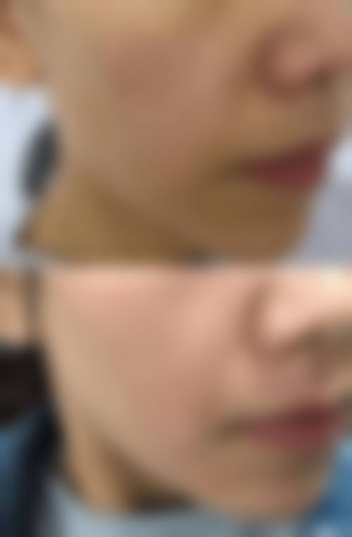 曹晗医生擅长项目